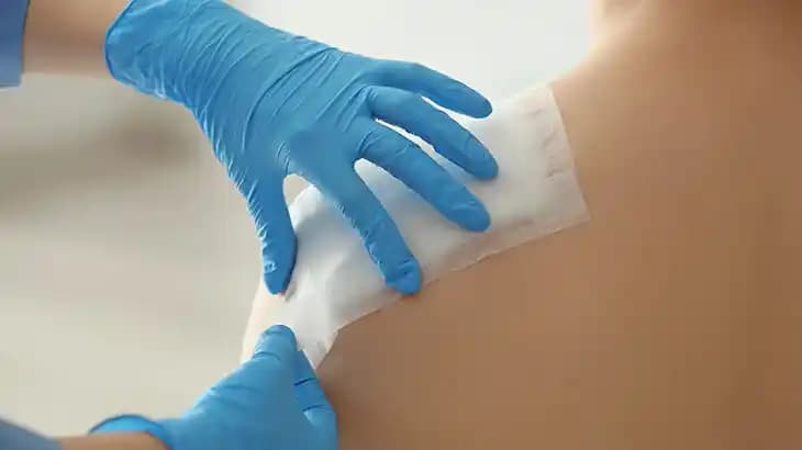 Kozmetik Ameliyat Sonrası Dikişlerin Kaşınması ve Bakım İpuçları