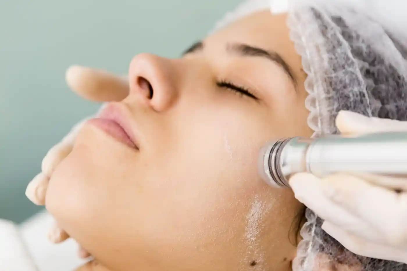 Kristal Peeling Nedir ve Cilt Sağlığına Etkileri Hakkında Detaylı Bilgi