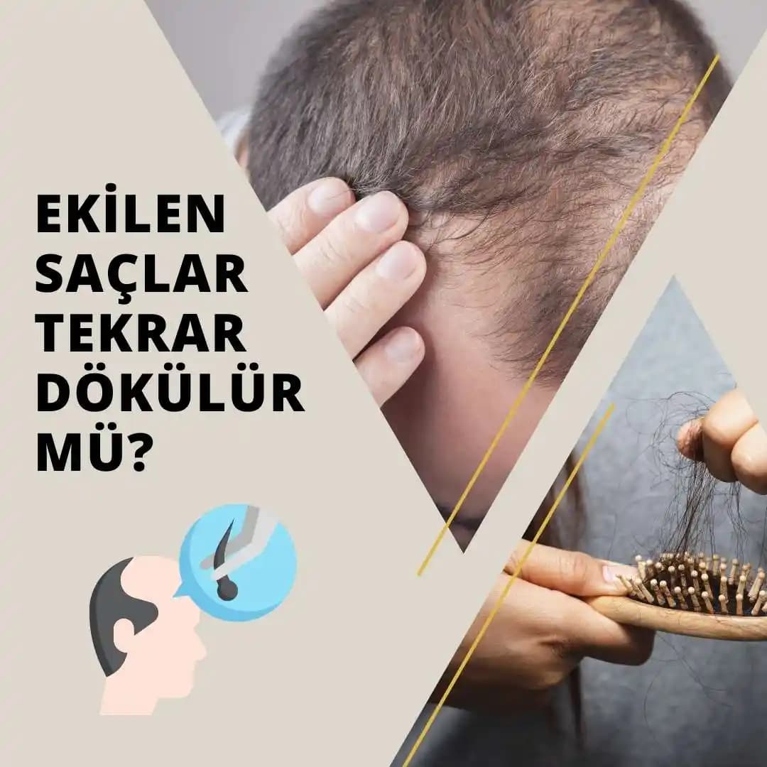 Kuru Saçların Nedenleri, Etkileri ve Etkili Bakım Yöntemleri