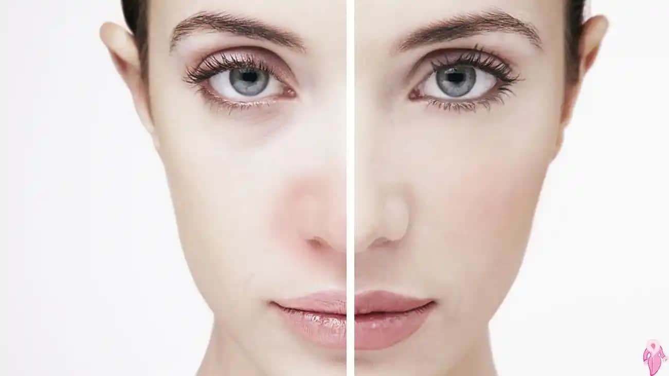 Makyaj Alerjisi Nedir, Belirtileri ve Güvenli Uygulama Yöntemleri