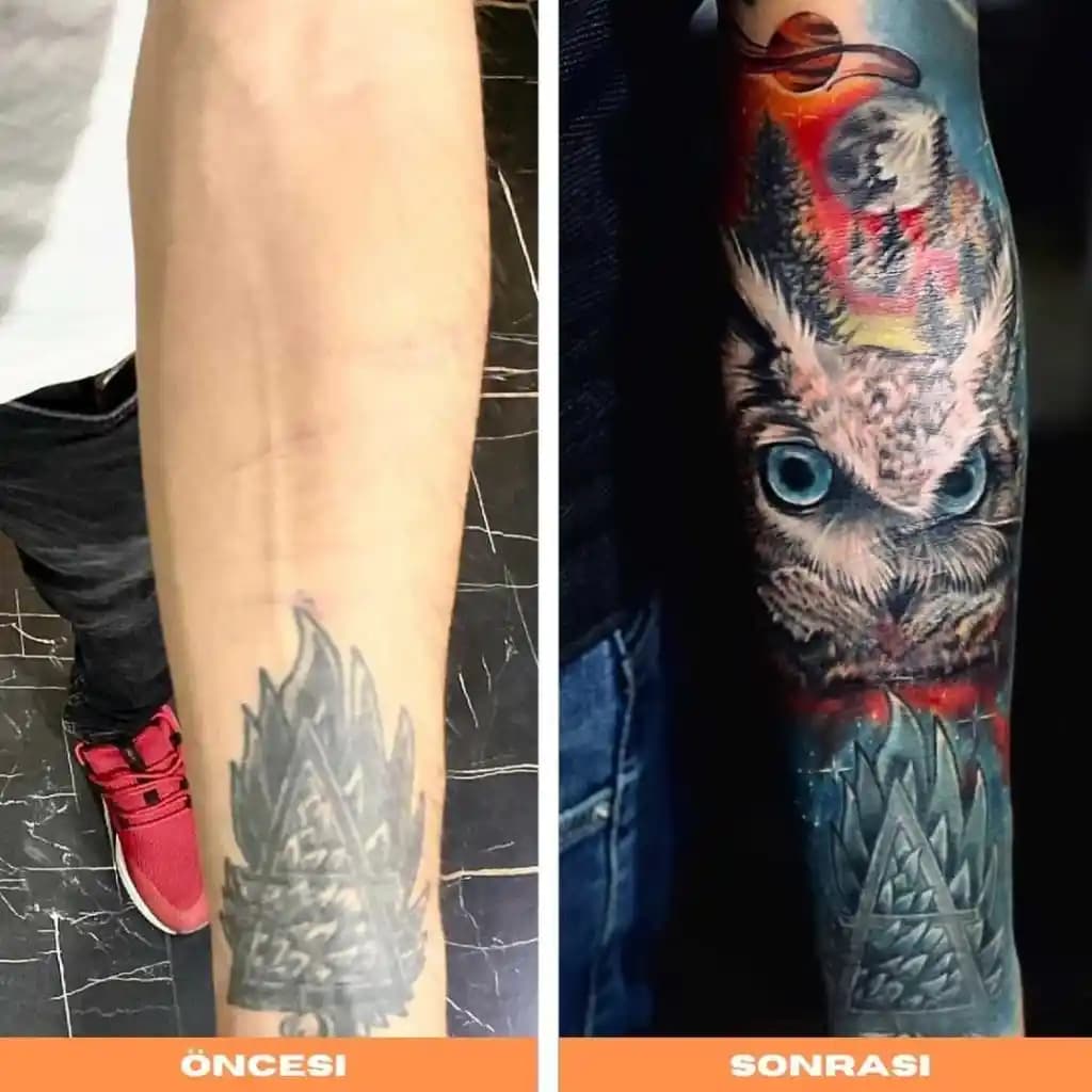 Minimal Dövme Kapatma Yöntemleri ve Estetik Çözümler Hakkında Kapsamlı Bilgi