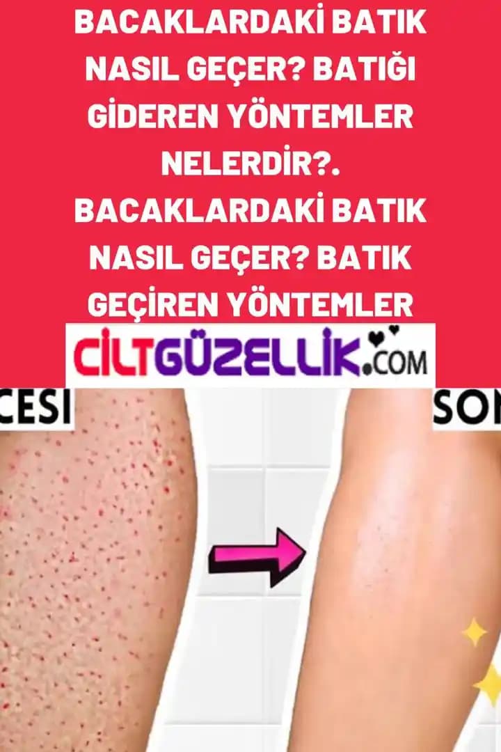 Portakal Görünümünü Azaltma Yöntemleri ve Cilt Sağlığı İçin En Etkili Yaklaşımlar