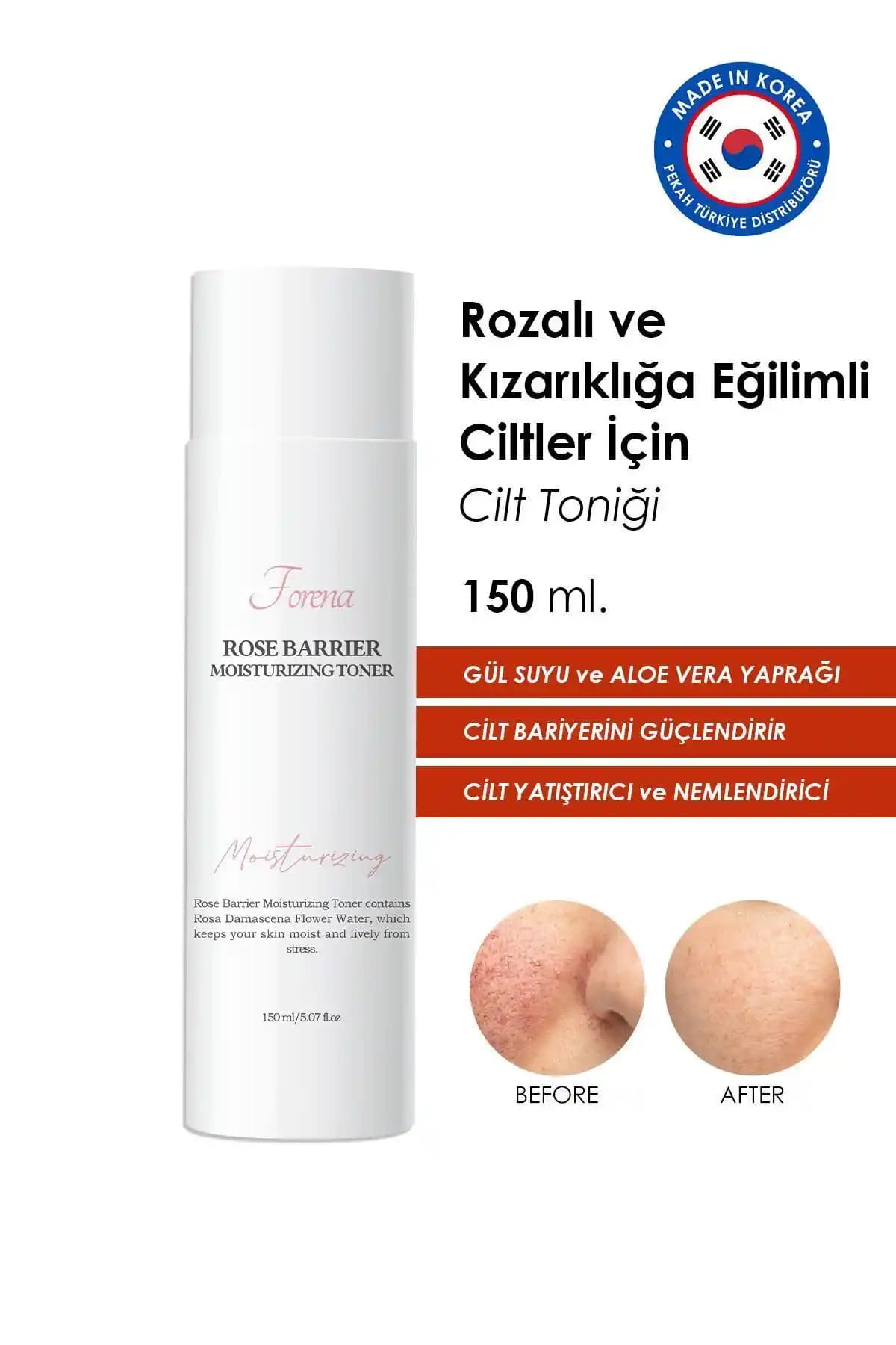 Rozalı ve Hassas Ciltler İçin Doğru Tonik Seçimi ve Bakım Rehberi