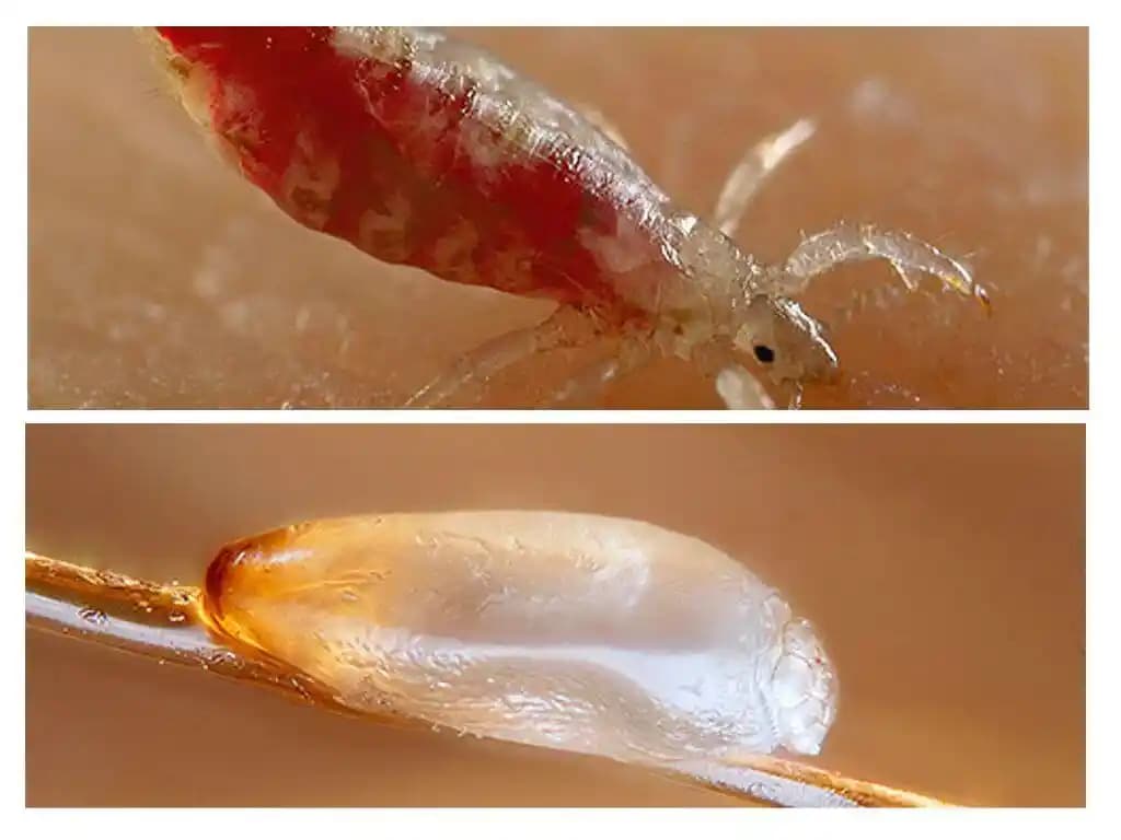 Sac Boyası Sirkeleri: Güvenlik ve Etkileri Hakkında Detaylı Bilgi ve Kullanım İpuçları