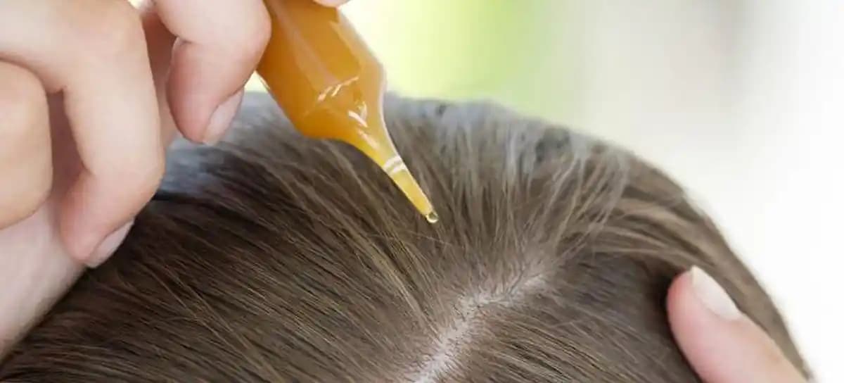 Saç Çıkmasını Destekleyen En Etkili Doğal Yağlar ve Bakım Yöntemleri