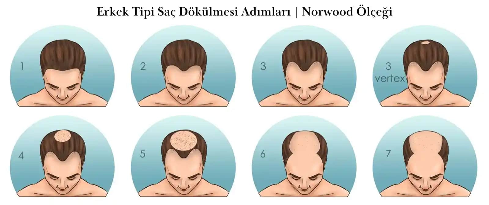 Saç Deri Dökülmesi Nedenleri ve Alınabilecek Önlemler Hakkında Detaylı Bilgi