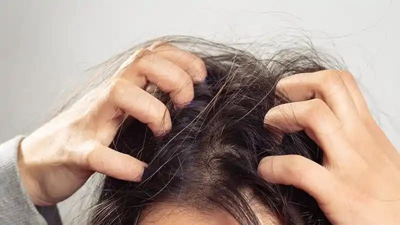 Saç Derisi Kaşıntısının Nedenleri ve Etkili Çözüm Yolları Hakkında Kapsamlı Rehber