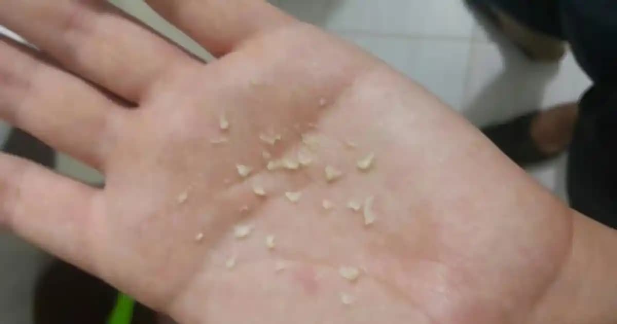 Saç Derisi Kaşıntısının Nedenleri ve Etkili Tedavi Yöntemleri