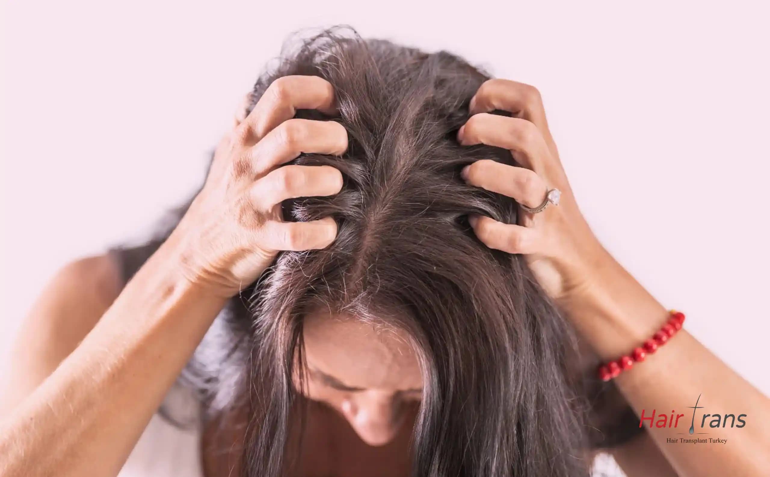 Saç Derisi Neden Ağrır ve Sağlıklı Saç Derisi İçin Alınması Gereken Önlemler