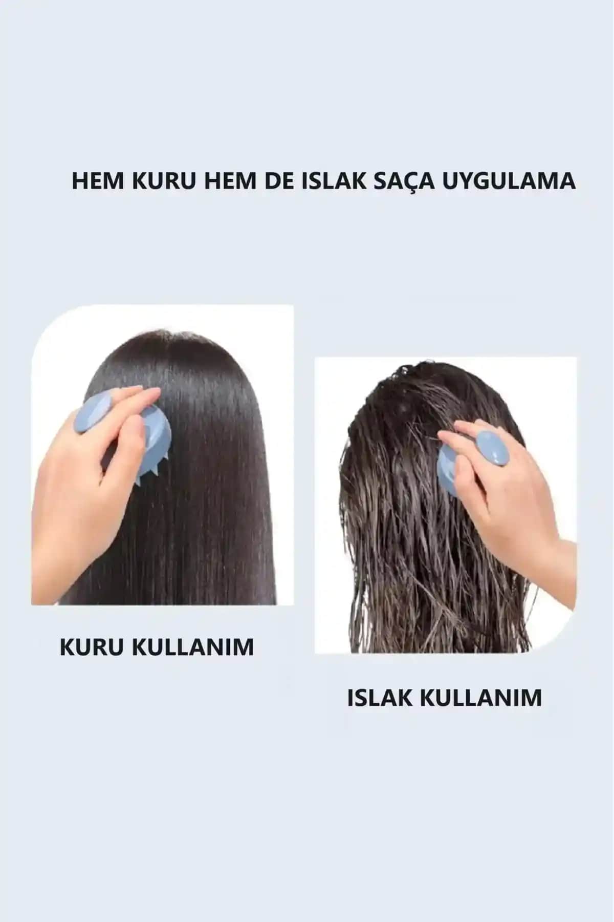 Saç Derisinde Kepek Sorunu ve Etkili Çözüm Yolları Hakkında Detaylı Bilgi