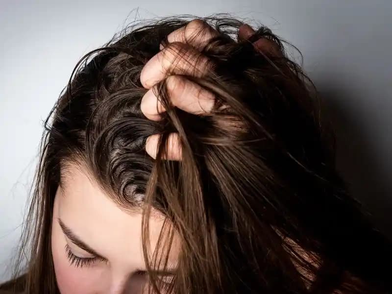 Saç Derisinde Sivilce Nedenleri ve Etkili Önleme Yöntemleri