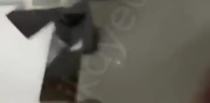 Saç Derisinden Sıvı Gelmesi Nedenleri, Belirtileri ve Tedavi Yöntemleri