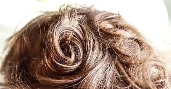 Saç Derisinin Ağrımasının Nedenleri ve Etkili Çözüm Yolları Hakkında Bilgiler