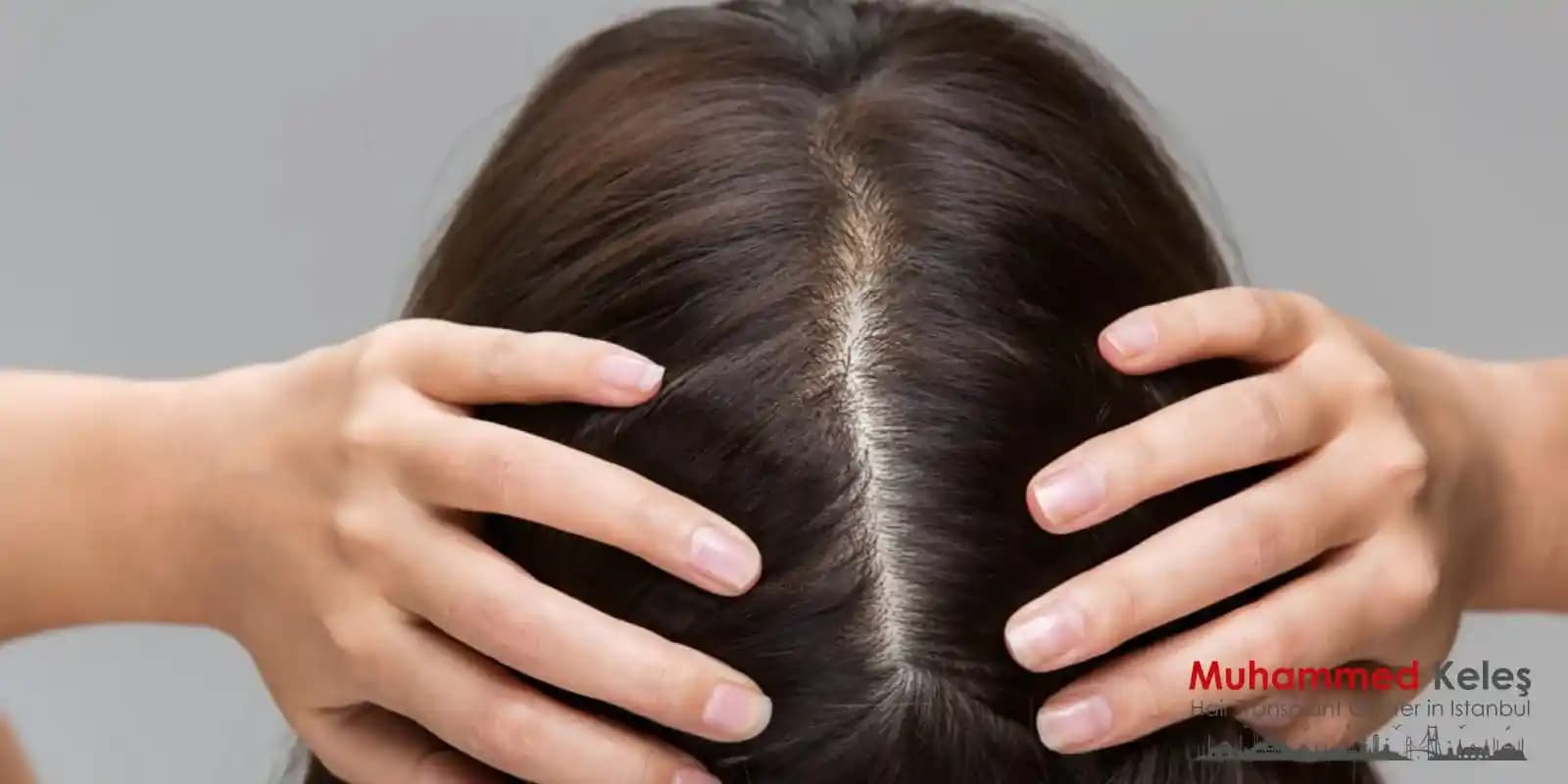 Saç Dibi Ağrısı Nedenleri Belirtileri ve Çözüm Yolları Hakkında Detaylı Bilgi