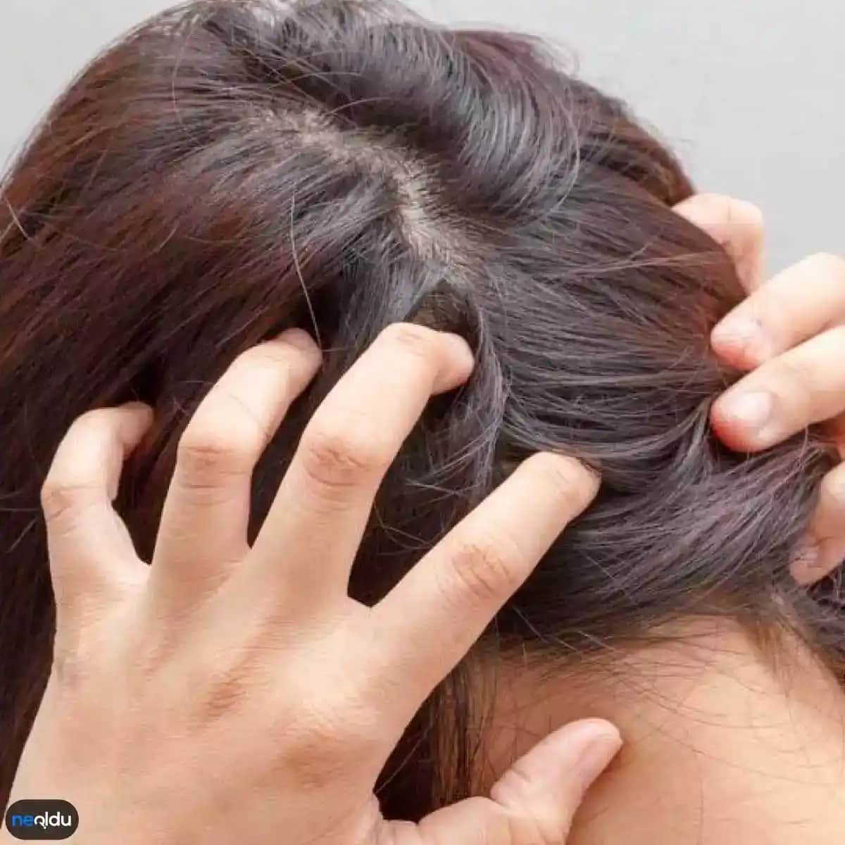 Saç Diplerindeki Kaşıntının Nedenleri ve Etkili Çözüm Yöntemleri