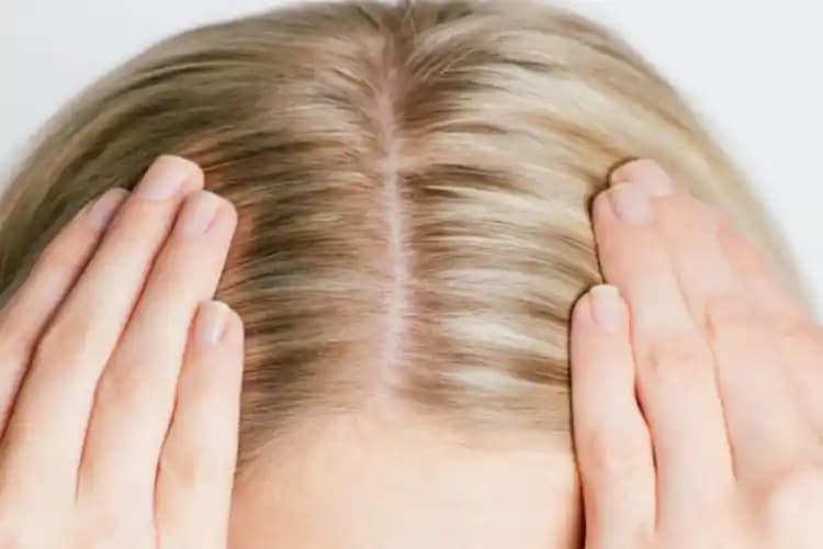 Saç Diplerindeki Yanma Hissi Nedenleri ve Rahatlatıcı Çözüm Yöntemleri