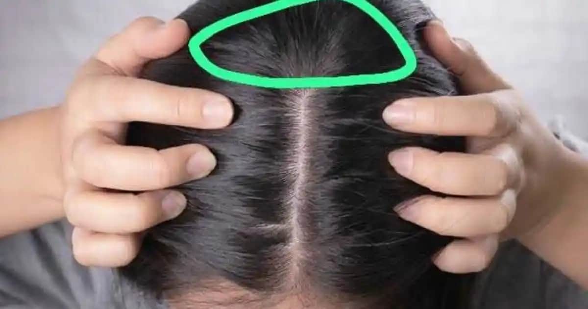 Saç Diplerinizdeki Ağrının Nedenleri ve Etkili Çözüm Yöntemleri