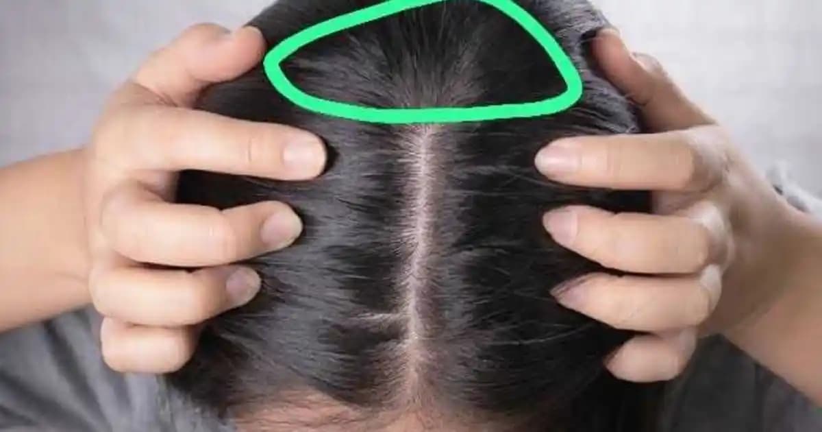 Saç Diplerinizdeki Ağrının Nedenleri ve Etkili Çözüm Yöntemleri