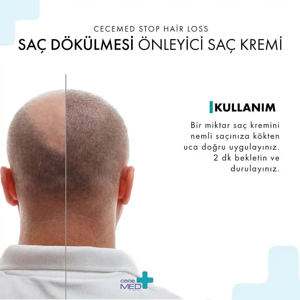 Saç Dökülmesi ve Sağlıklı Saç Derisi İçin Bilmeniz Gerekenler