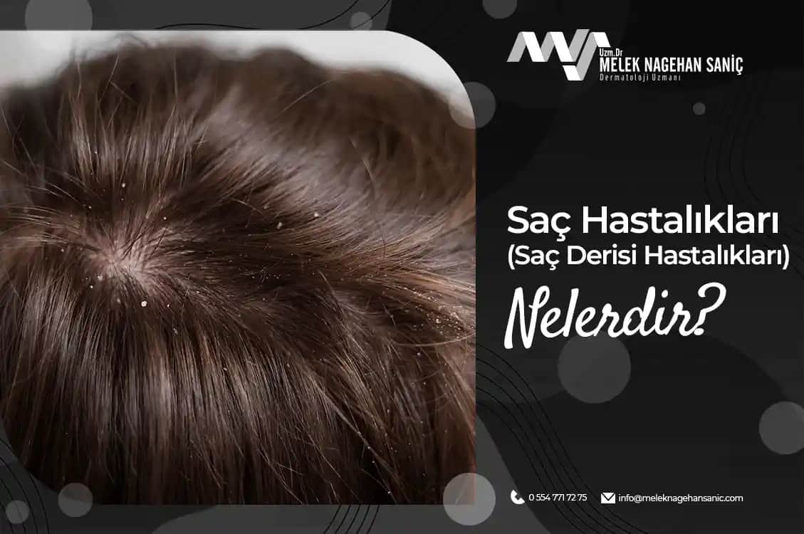 Saç Kokusuna Neden Olan Sağlık Problemleri ve Çözüm Yolları Hakkında Bilgilendirici Rehber