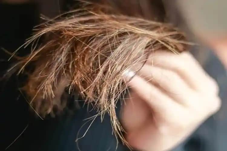 Saç Kopması Nedenleri ve Saç Sağlığını Koruma Yöntemleri Rehberi