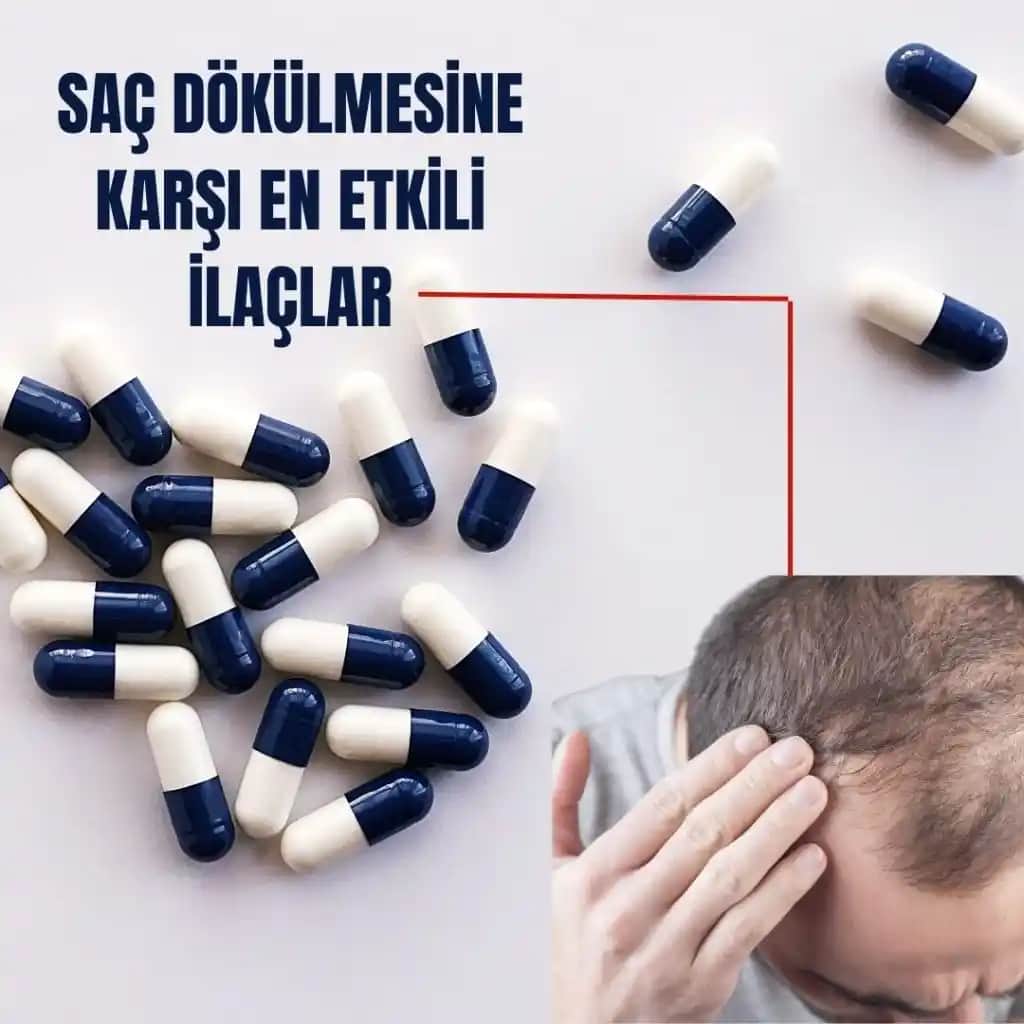 Saç Nezlesi Belirtileri, Nedenleri ve Doğal Tedavi Yöntemleri Hakkında Kapsamlı Bilgi