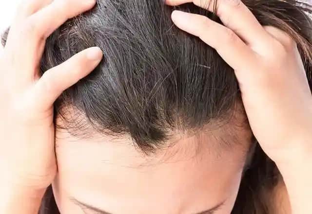 Saç Nezlesi Nedenleri Belirtileri ve Korunma Yöntemleri Hakkında Detaylı Rehber