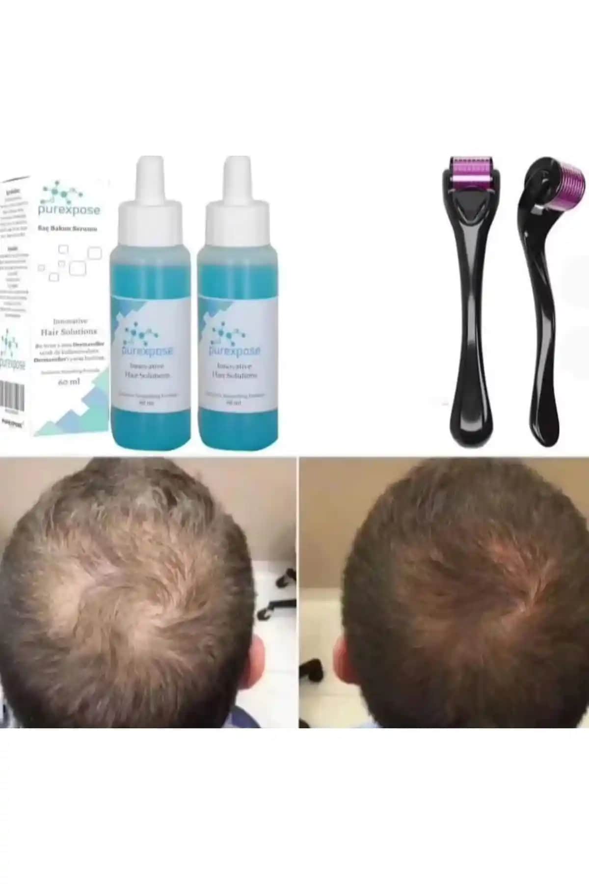 Saç Rolonu Kullanımı ve Farklı Tekniklerle Doğal ve Hacimli Saçlar Yaratma