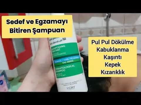 Saç Sağlığı İçin En İyi Sedef Şampuanları ve Doğru Seçim Rehberi