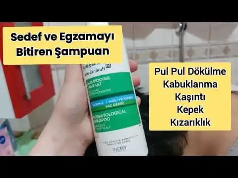 Saç Sağlığı İçin En İyi Sedef Şampuanları ve Doğru Seçim Rehberi
