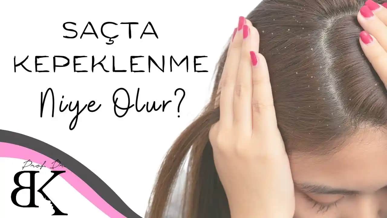 Saç ve Sakal Kepeklenmesi Nedenleri ve Etkili Tedavi Yöntemleri Rehberi