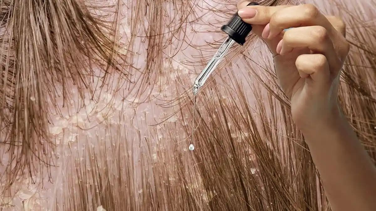 Saçı En Hızlı Uzatan Doğal Yağlar ve Kullanım Yöntemleri