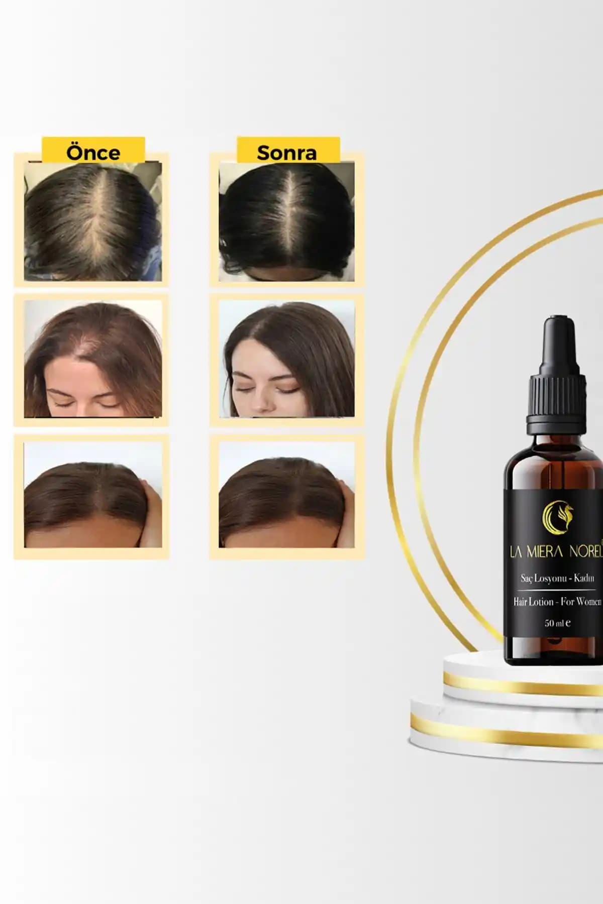 Saçı Güçlendiren Yöntemler: Doğal ve Klinik Yaklaşımlarla Saç Sağlığını Destekleme