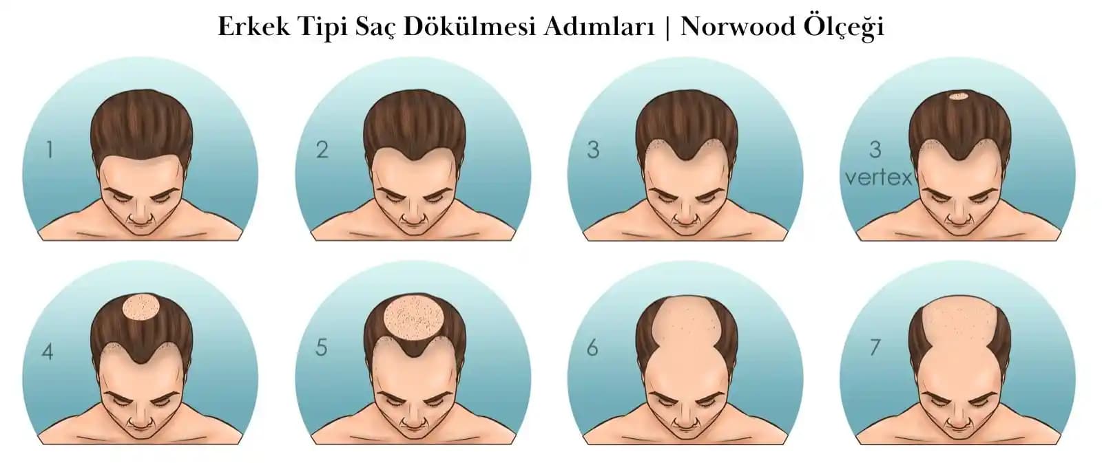 Saçın Pul Pul Dökülmesi Nedenleri ve Etkili Çözüm Yöntemleri