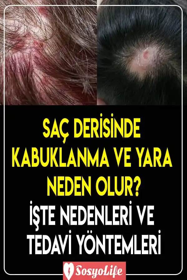 Saçın Yapısı ve Sağlıklı Kalması İçin Bilmeniz Gerekenler