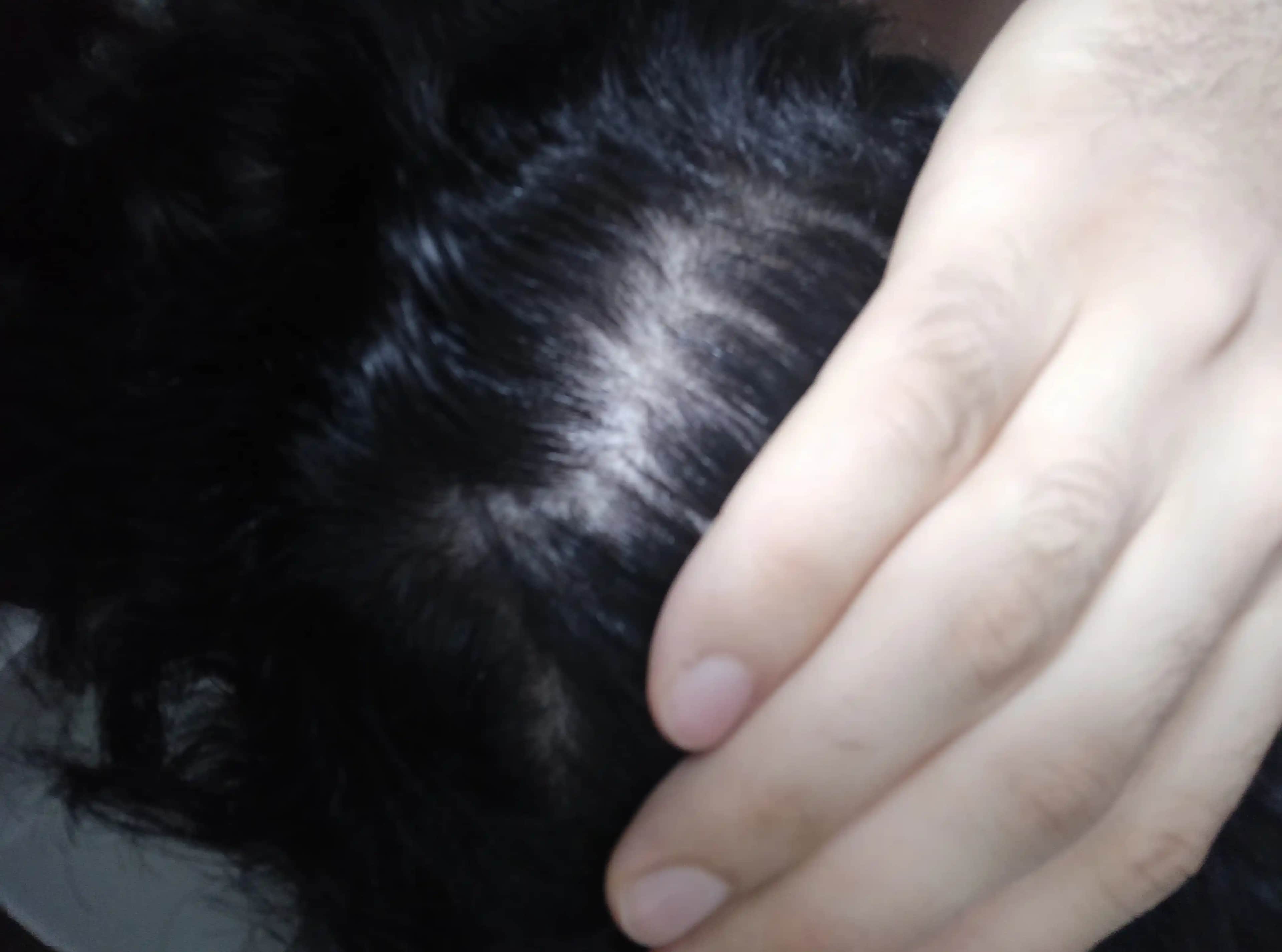 Saçta Kaşınma ve Dökülme Nedenleri, Çözümleri ve Bakım İpuçları