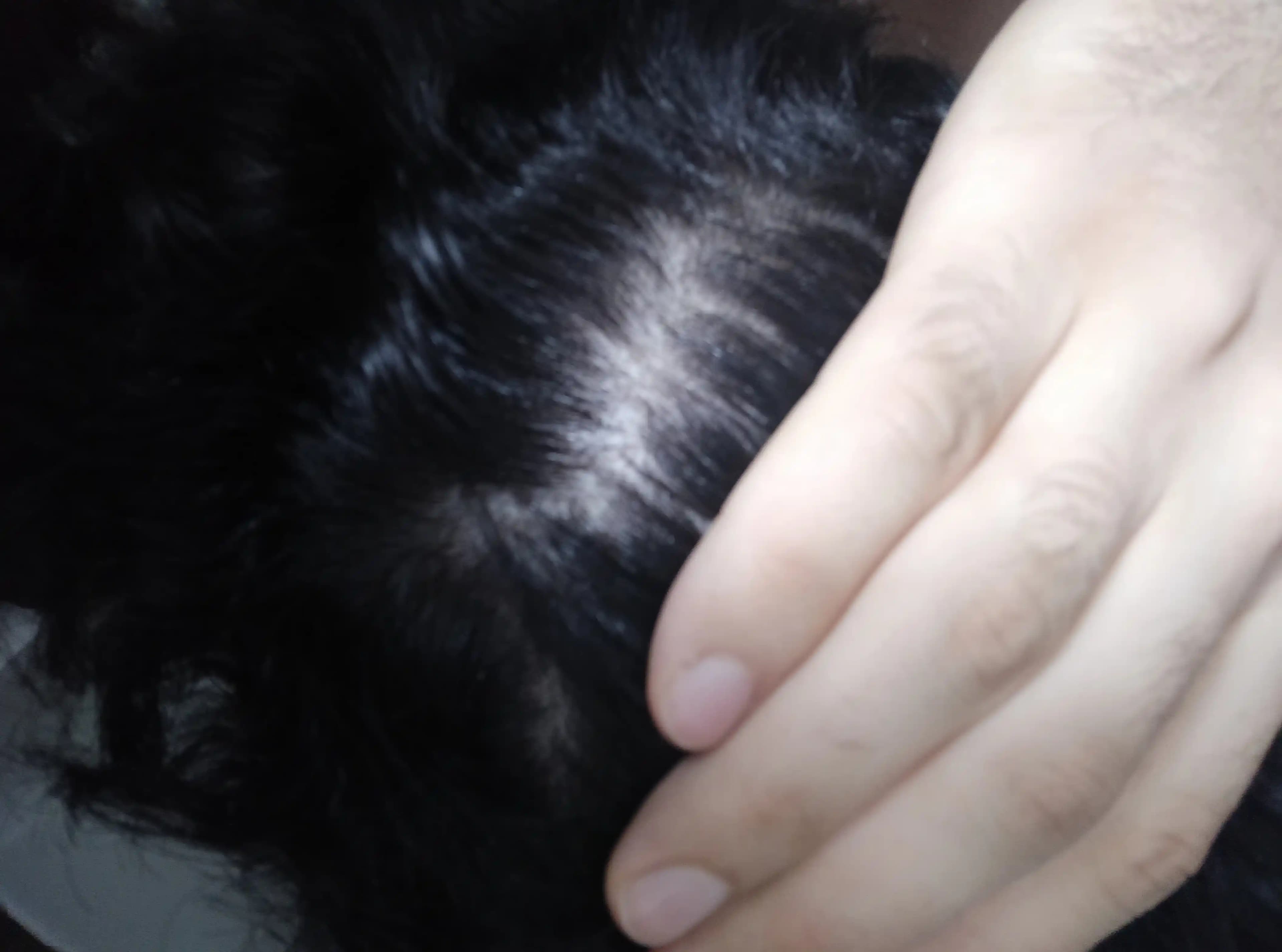 Saçta Kaşınma ve Dökülme Nedenleri, Çözümleri ve Bakım İpuçları