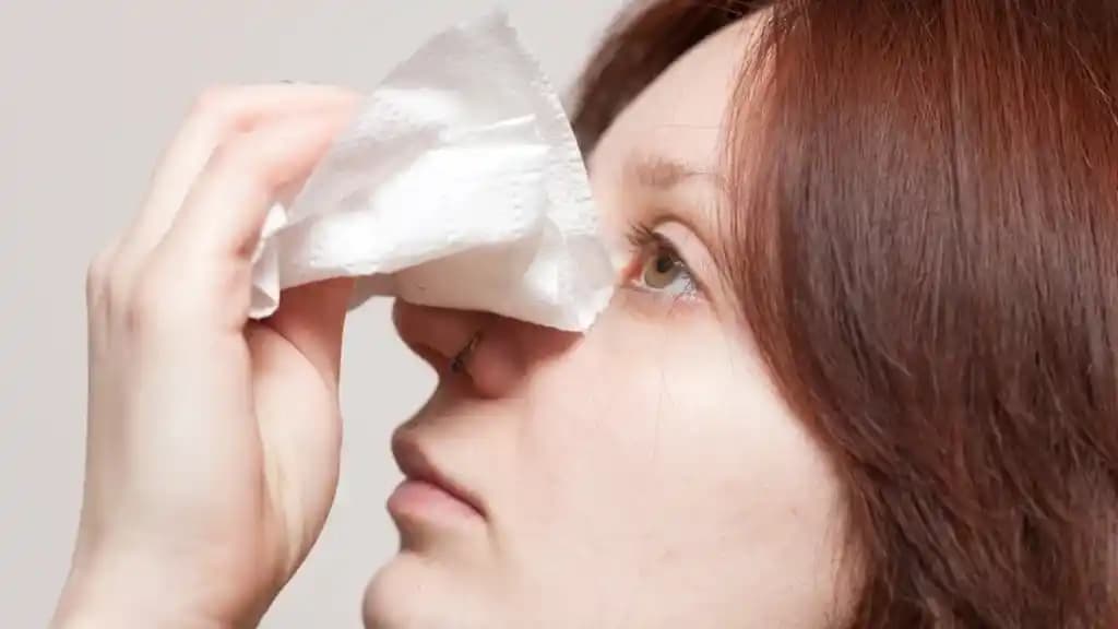 Saçta Sivilce Sorunu ve Etkili Çözüm Yolları Hakkında Bilmeniz Gerekenler