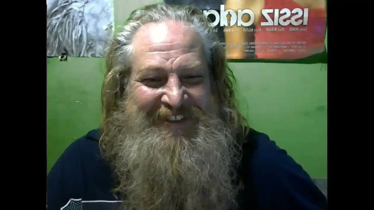 Sakal Altı Deri Dökülmesi Nedenleri ve Etkili Kozmetik Bakım Yöntemleri