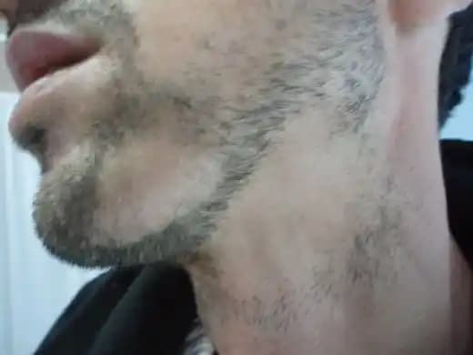 Sakal ve Saçkıran Sorunu İçin Güncel Erkek Bakım Yöntemleri ve Çözüm Tavsiyeleri