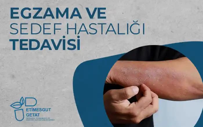 Sedef ve Egzama Arasındaki Farklar ve Doğru Cilt Bakımı Yaklaşımları