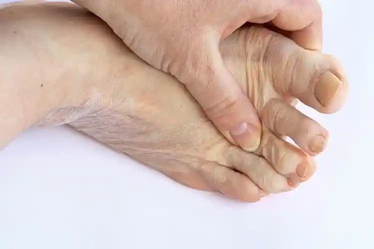 Sedefi Nedir, Neleri Tetikler ve Nasıl Kontrol Altına Alınır