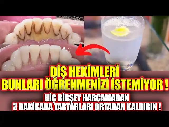 Sigara Lekeleriyle Mücadele ve Dişlerinizi Parlatan Temizlik Yöntemleri