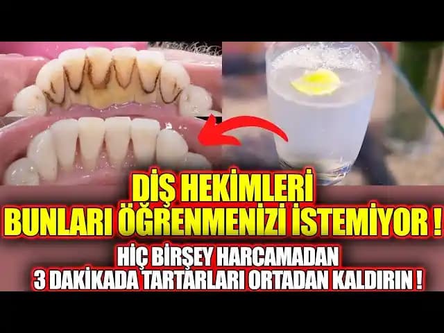 Sigara Lekeleriyle Mücadele ve Dişlerinizi Parlatan Temizlik Yöntemleri