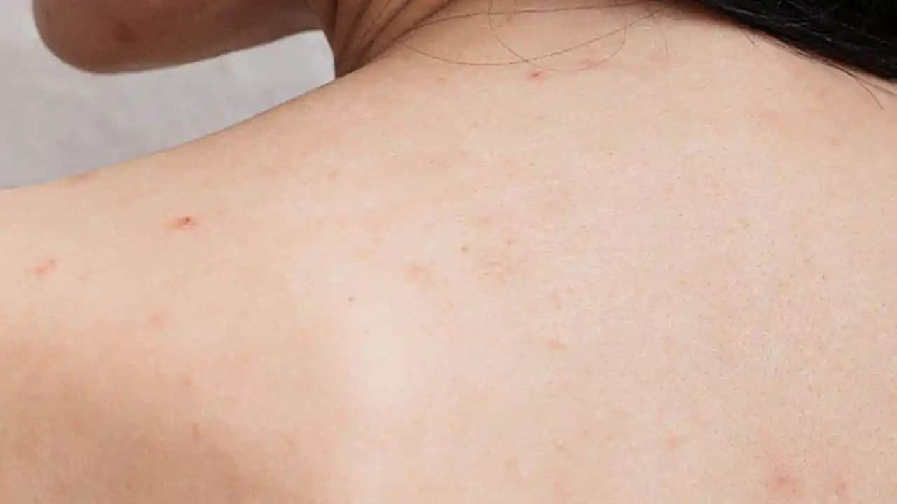 Sırttaki Sivilcelere Karşı Etkili Yöntemler ve Doğal Çözümler Rehberi