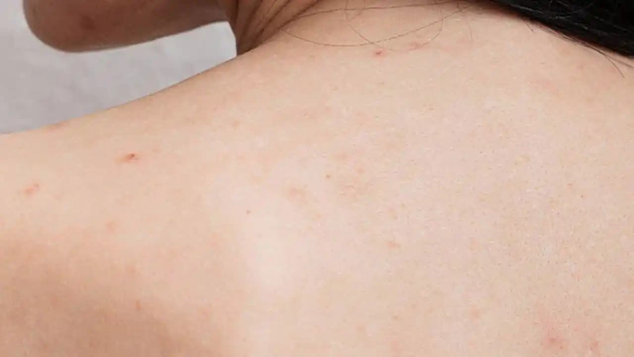 Sırttaki Sivilcelere Karşı Etkili Yöntemler ve Doğal Çözümler Rehberi