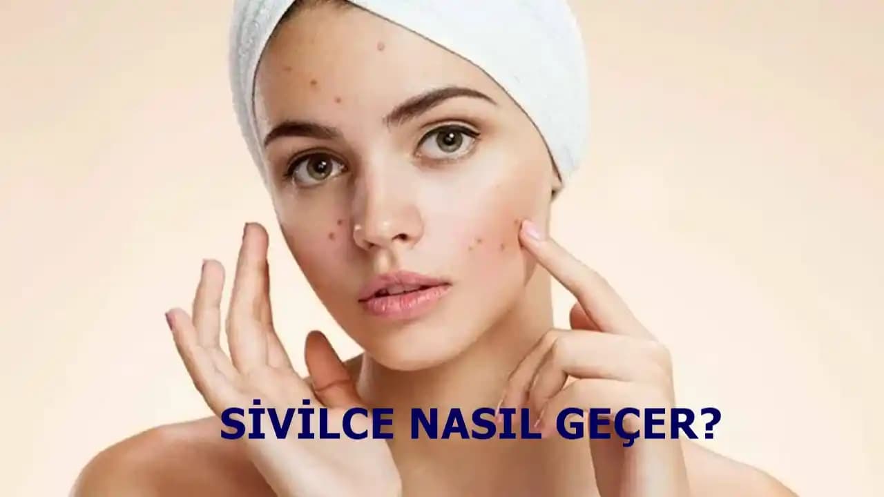 Sivilce Ağrısına Karşı Etkili Çözüm Yöntemleri ve Cilt Bakımı İpuçları