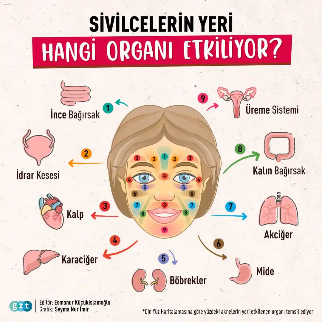 Sivilce Oluşumu ve Cilt Sağlığı İçin Bilmeniz Gerekenler