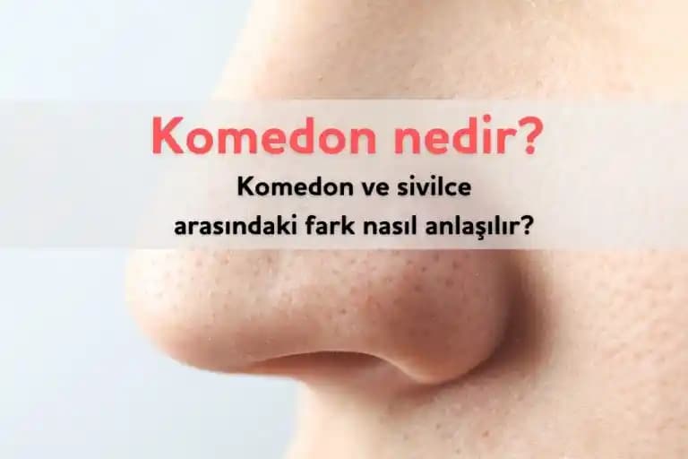 Sivilce ve Komedonlar: Cilt Sağlığını Koruma ve Doğru Bakım Yöntemleri