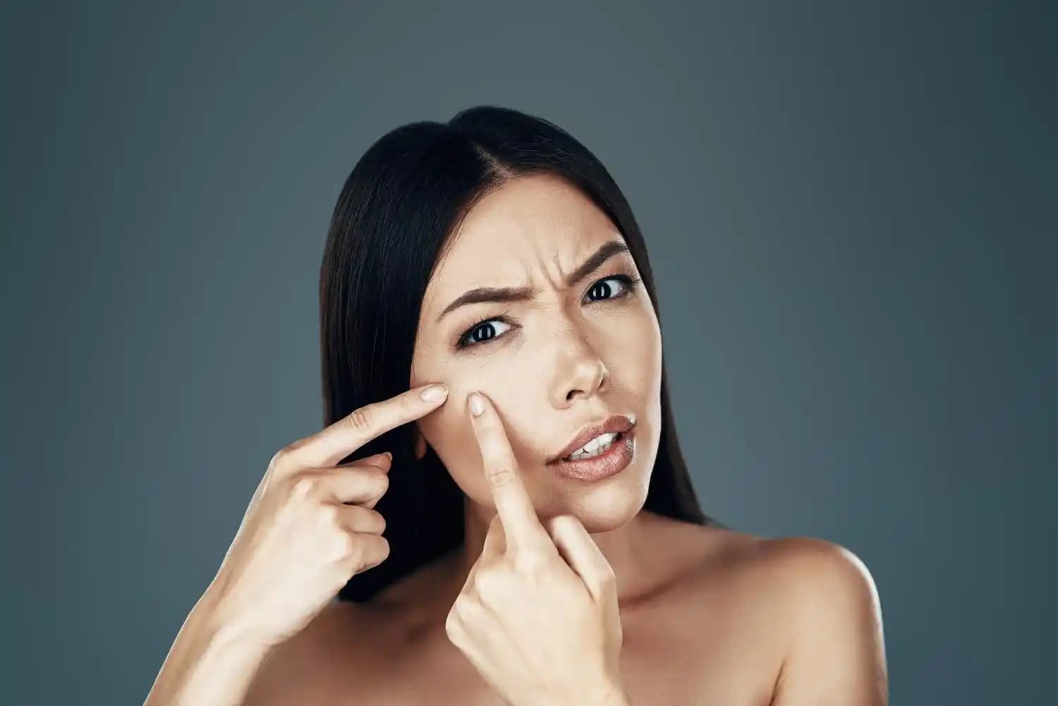 Sivilceler Kendiliğinden Geçer Mi Sorusu ve Doğru Cilt Bakımı Yöntemleri